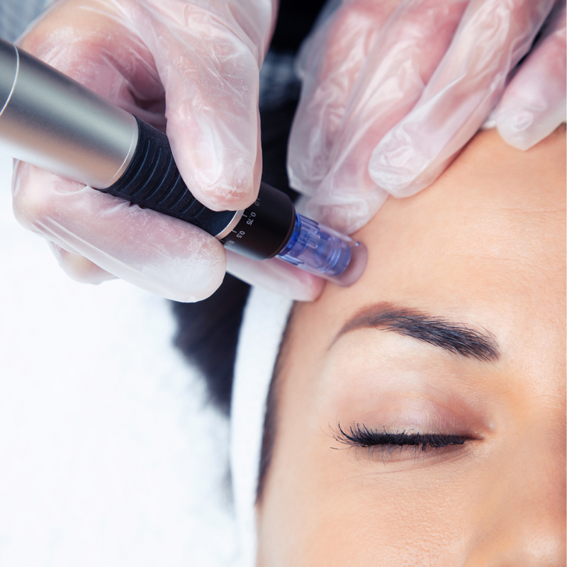 Cosmetic Services at SkinHappy