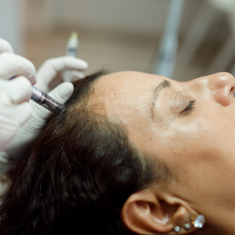 Hair Restoration Therapy at SkinHappy