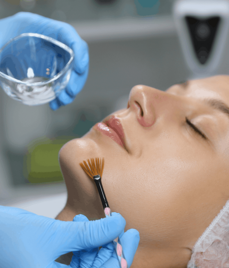 Woman receiving a chemical peel treatment with a brush and small container in a clinical setting.