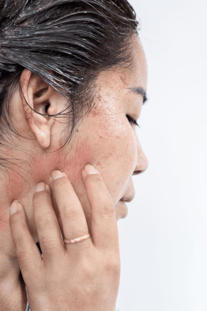  A person scratches a rash on their neck.