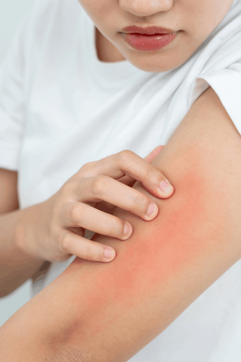 A person examines a rash on their arm.